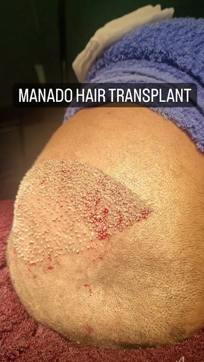 Klinik Rambut Manado 2026: Solusi Tepat Atasi Kerontokan dan Kebotakan di Sulawesi Utara