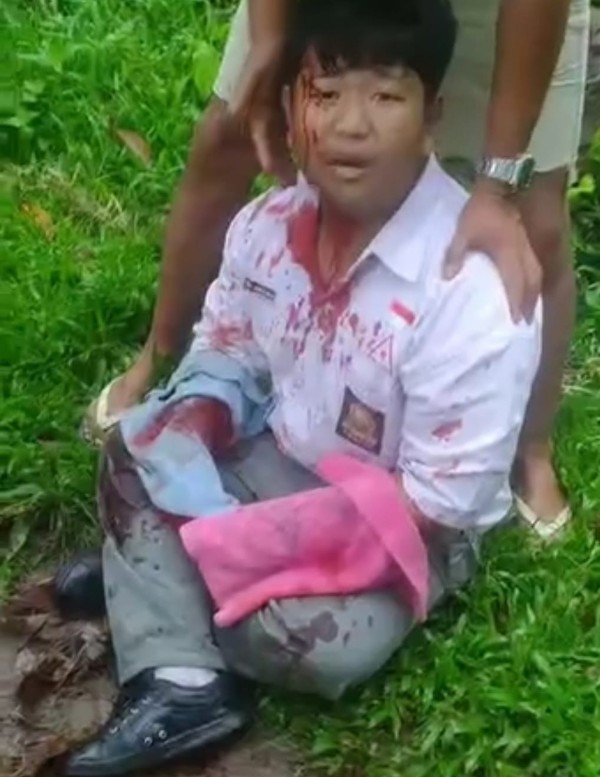 Pelajar SMAN 5 Binjai Dibacok Begal di Dekat Kuburan, Polres Bentuk Tim Khusus Pengejaran