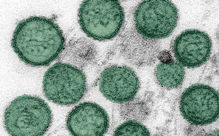 Menkes Budi Gunadi Pastikan Pasien Hantavirus di RSPI Sulianti Saroso Sudah Pulang, Tidak Ada Penularan