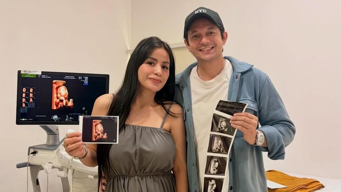 Andrew Andika dan Violentina Kaif Umumkan Kehamilan Anak Perempuan, Sempat Yakin Dapat Bayi Laki-laki
