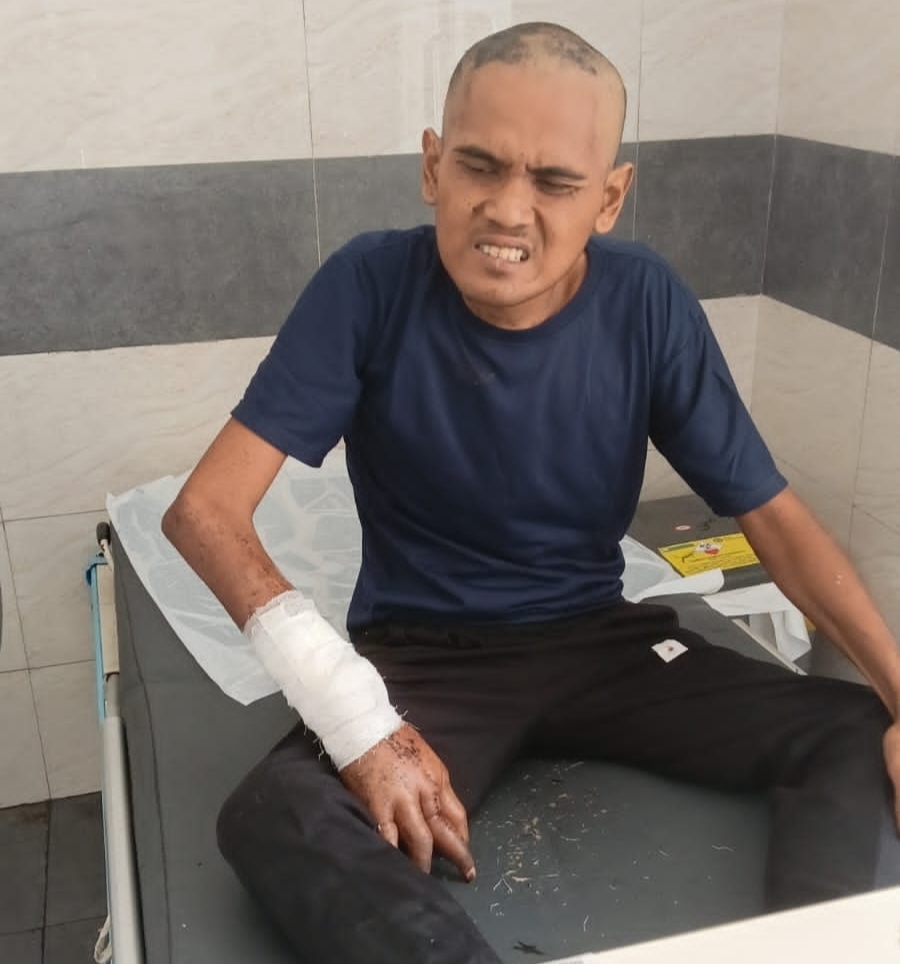 ODGJ Terlantar di Depan Panti Sosial Karawang Ditemukan Tidur di Bangunan Kosong, Kini Dirawat di RSUD