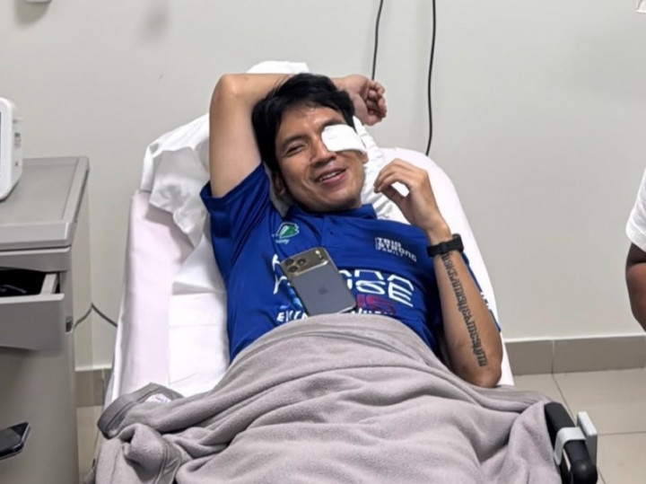 Mata Kiri Desta Alami Pendarahan Setelah Kena Smash Keras di Turnamen Padel, Begini Kondisi Terkini