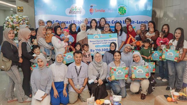 17 Anak Indonesia Jalani Operasi Bibir Sumbing Gratis, Kolaborasi Alamii Food dan Smile Train