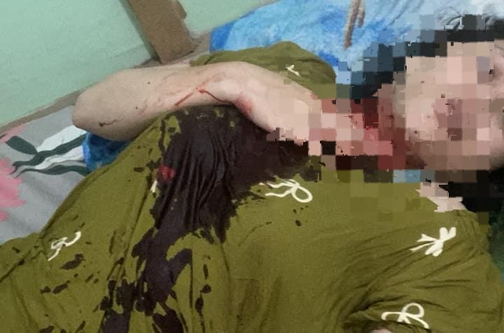 Mahasiswi Magang di Toboali Dianiaya hingga Leher Bersimbah Darah, Polisi Basemah Buru Pelaku