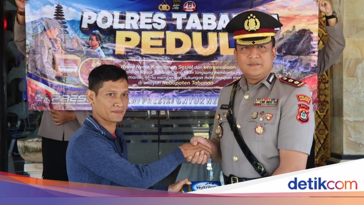 Polres Tabanan Salurkan Bantuan Susu dan Pampers untuk Balita Pengidap Kelainan Jantung DORV di Selemadeg Barat