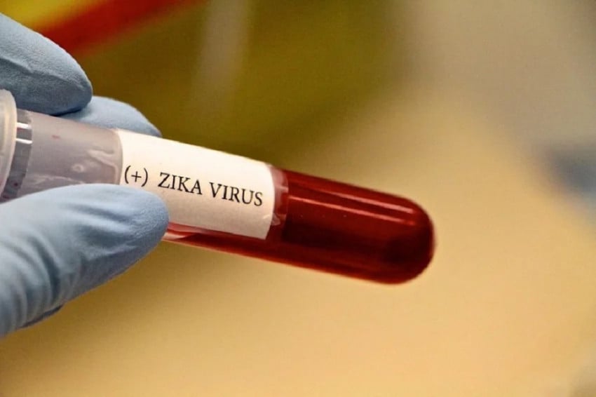 Virus Zika di Bali: CDC Terbitkan Travel Health Notice, Ini yang Perlu Ibu Hamil Tahu