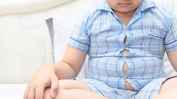 Cek Kesehatan Anak Sekolah: Karies Gigi, Obesitas, dan Darah Tinggi Mendominasi