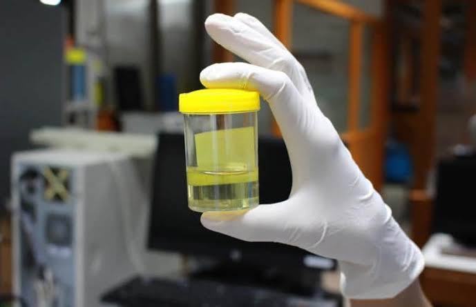 BNN Bolmong Siap Tes Urine Massal Pejabat Pemkab Bolsel dan DPRD, Peringatkan Hasil Lama Tak Berlaku