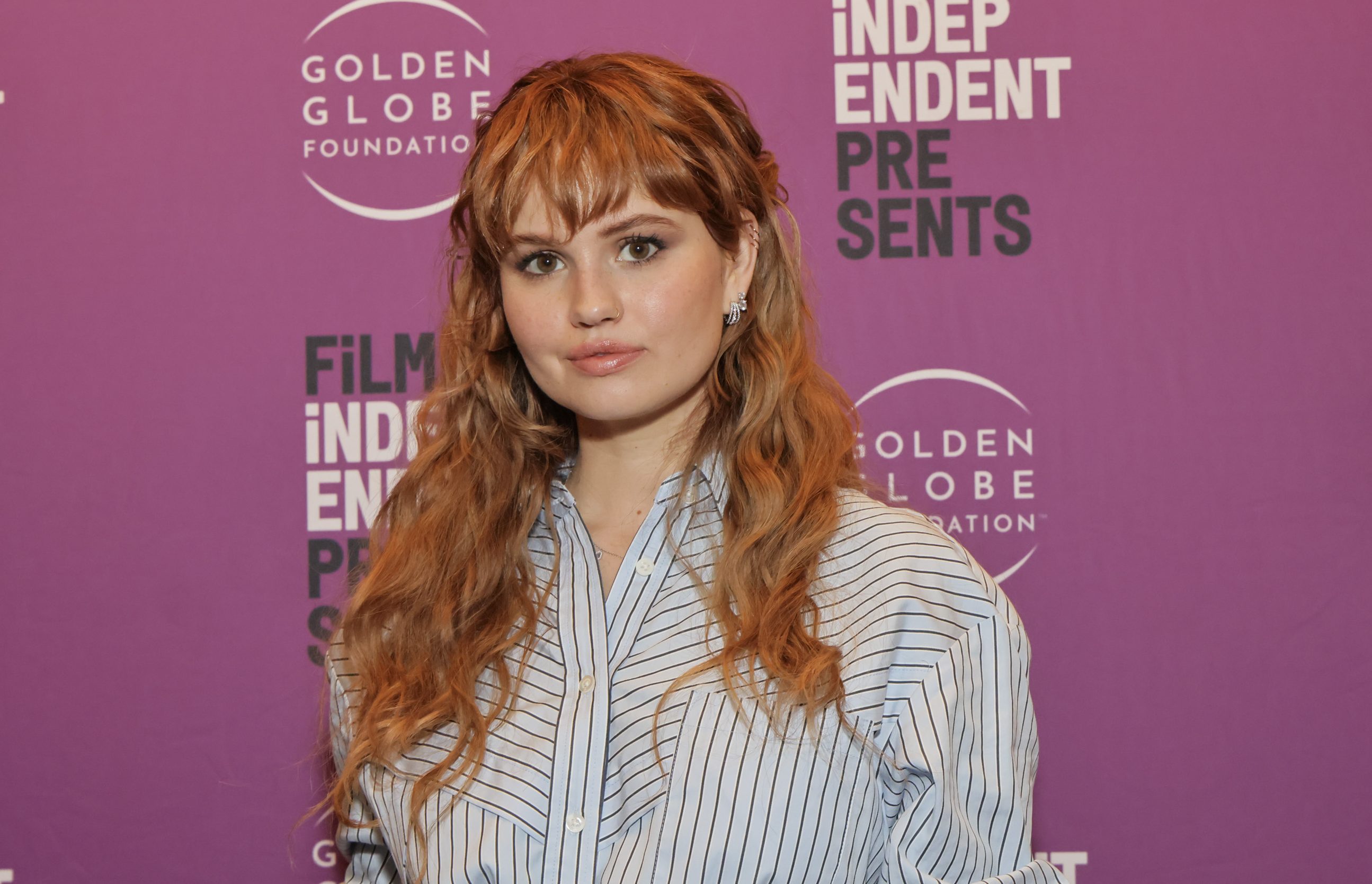 Debby Ryan Ungkap Cedera Otak Berat Usai Lima Kali Gegar Otak