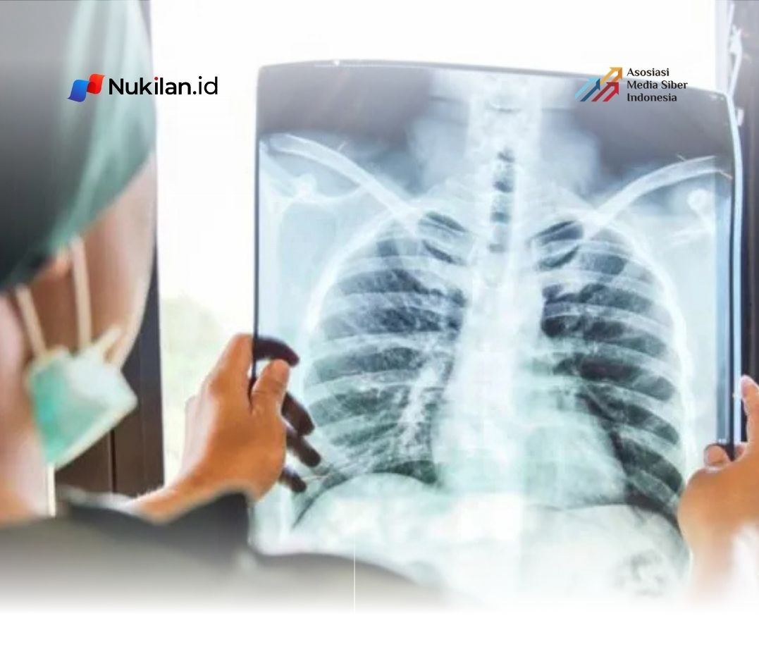 Biaya Pengobatan Penyakit Akibat Rokok di Banda Aceh Capai Rp113,7 Miliar, 42 Ribu Warga Jadi Pasien