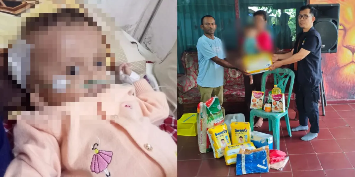 Bayi 11 Bulan Asal Maluku Tenggara Idap Hidrosefalus, Tempuh Laut 24 Jam ke Ambon