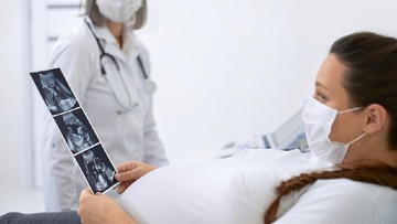 Infeksi TORCH Saat Hamil dan Risiko Autisme Anak: Panduan untuk Ibu