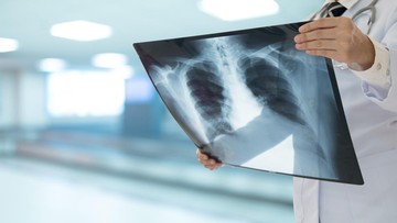 Pekerja Lab Siberia Meninggal, Dugaan Pes Paru Picu Pemantauan 200 Kontak