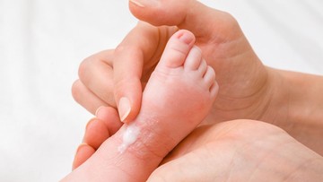 Kulit Kering Bayi: Penyebab dan Cara Mengatasinya dengan Tepat