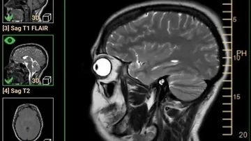 Foto Medis Langka Ini Tampilkan Fenomena Tubuh yang Sulit Dipercaya