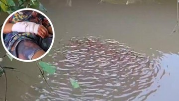 Ikan Gabus Raksasa Serang Bocah 13 Tahun di Thailand, Tangan Luka Parah