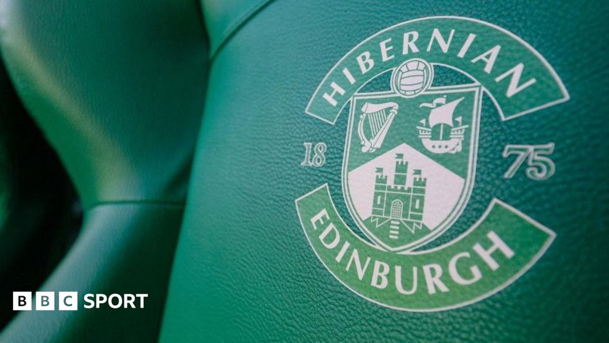 Hibernian Ban Kelompok Suporter Block Seven Tiga Laga Usai Rusuh di Tannadice