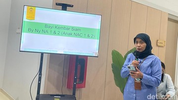 Kembar Siam NA 1 dan NA 2 di RSCM Pulih, Ini Tahapan Lanjutannya