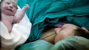 Maternal Assisted Caesarean: Ibu Bisa Angkat Bayi Sendiri saat Operasi Caesar