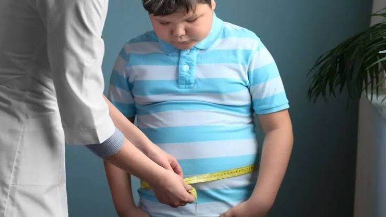 Obesitas pada Anak: Penyebab, Risiko, dan Cara Mencegahnya