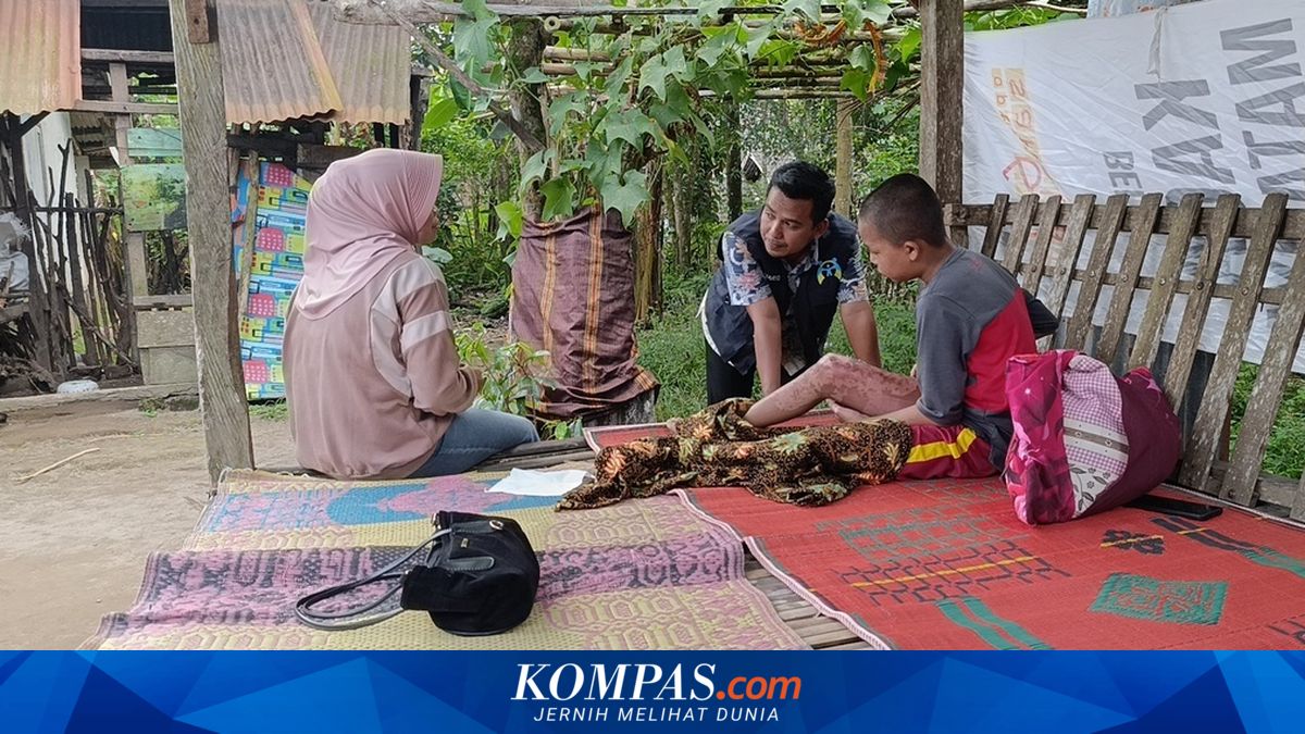 2 Santri Korban Kebakaran di Ponpes Lombok Tengah Diundang RDP ke Komisi III DPR, Perjuangkan Biaya Pengobatan