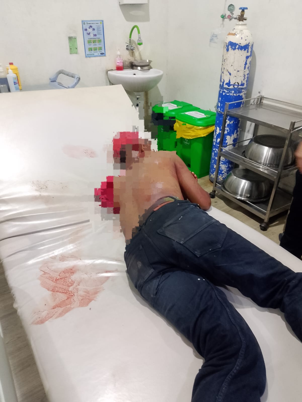 6 Pemuda Bacok Sekuriti Gudang di Medan Labuhan Gara-gara Tak Dipinjami Becak, Korban Dirawat dengan 15 Jahitan