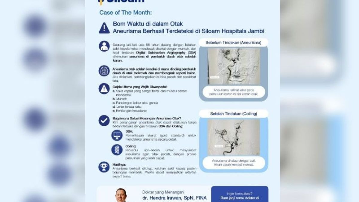 Siloam Hospitals Jambi Tangani Aneurisma Otak Pasien 66 Tahun Tanpa Operasi Terbuka, Ini Prosedurnya