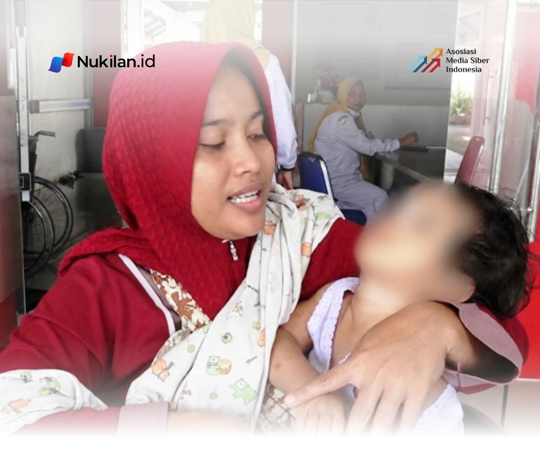 Polres Aceh Timur Operasi Bibir Sumbing Gratis 30 Pasien di RSUD dr. Zubir Mahmud, Haru Orang Tua