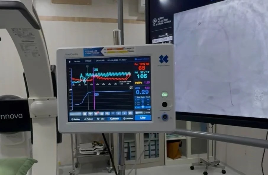 RSUD Meuraxa Banda Aceh Jadi RS Pertama di Aceh dengan Teknologi Diagnosa Jantung Presisi, Pasien Tak Perlu ke Luar Daerah