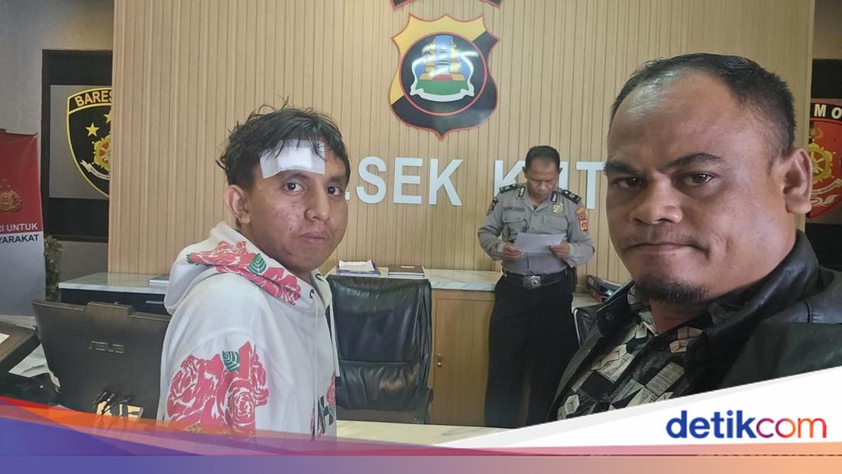 Pria Asal Sumba Disiksa dan Diperas Rp 100 Juta di Bali Usai Dijebak Loker Hotel Palsu, 2 Pelaku Wanita Buron