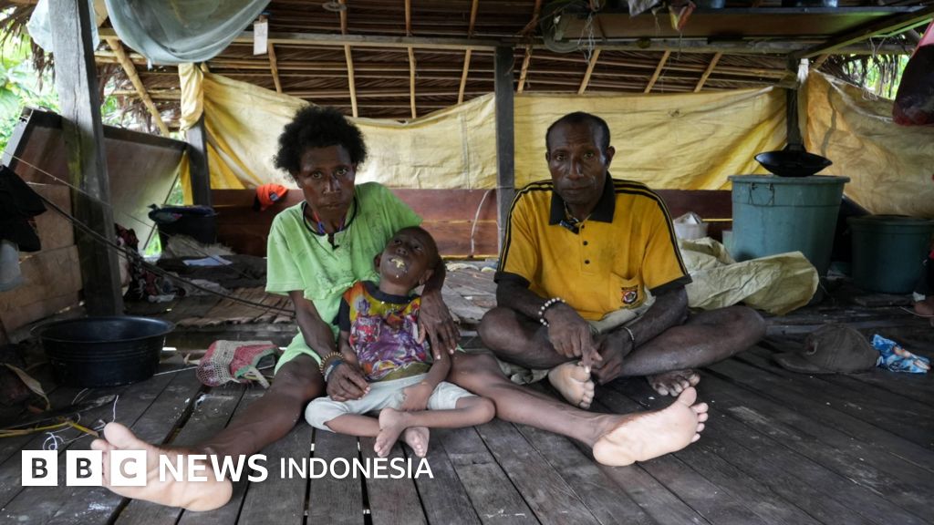 Hanya 1% Dapur MBG di Papua, Wilayah Stunting Tertinggi: Anak Lumpuh di Mamberamo Raya Tak Pernah ke Dokter