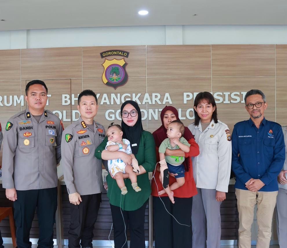 Sambut Hari Bhayangkara ke-80, Polda Gorontalo Operasi Bibir Sumbing Gratis 20 Anak, Digelar Tiap Tahun