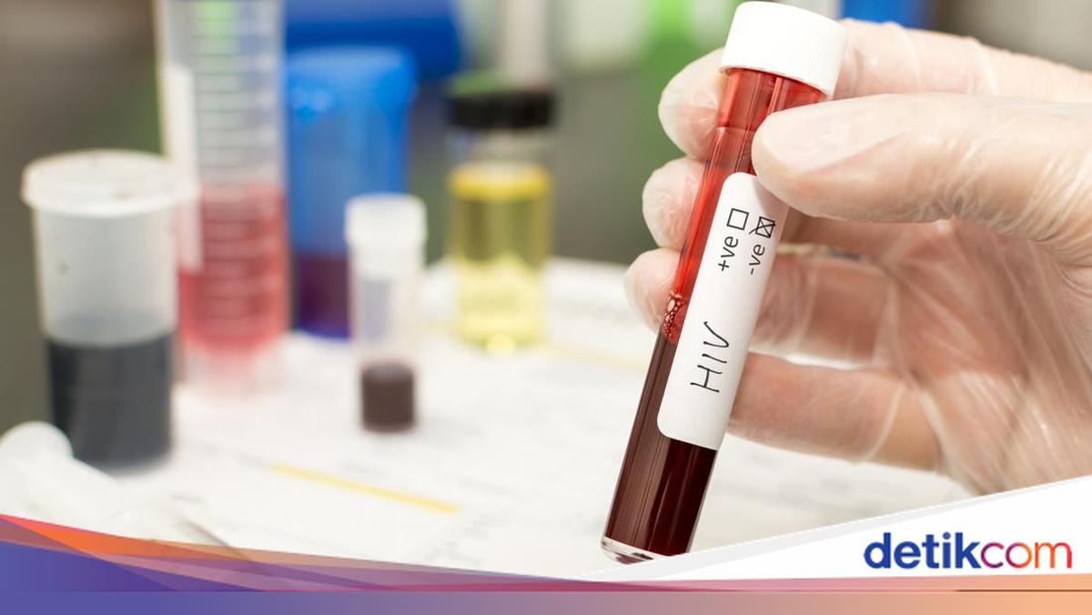 206 dari 380 Kasus HIV/AIDS Baru di Sumsel Disumbang Hubungan Heteroseksual, Palembang Tertinggi