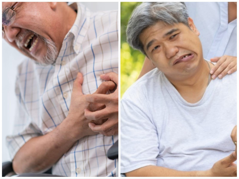 Stroke Ancam Orang Sehat di Aceh, 1 dari 4 Kasus Terjadi pada Usia Produktif
