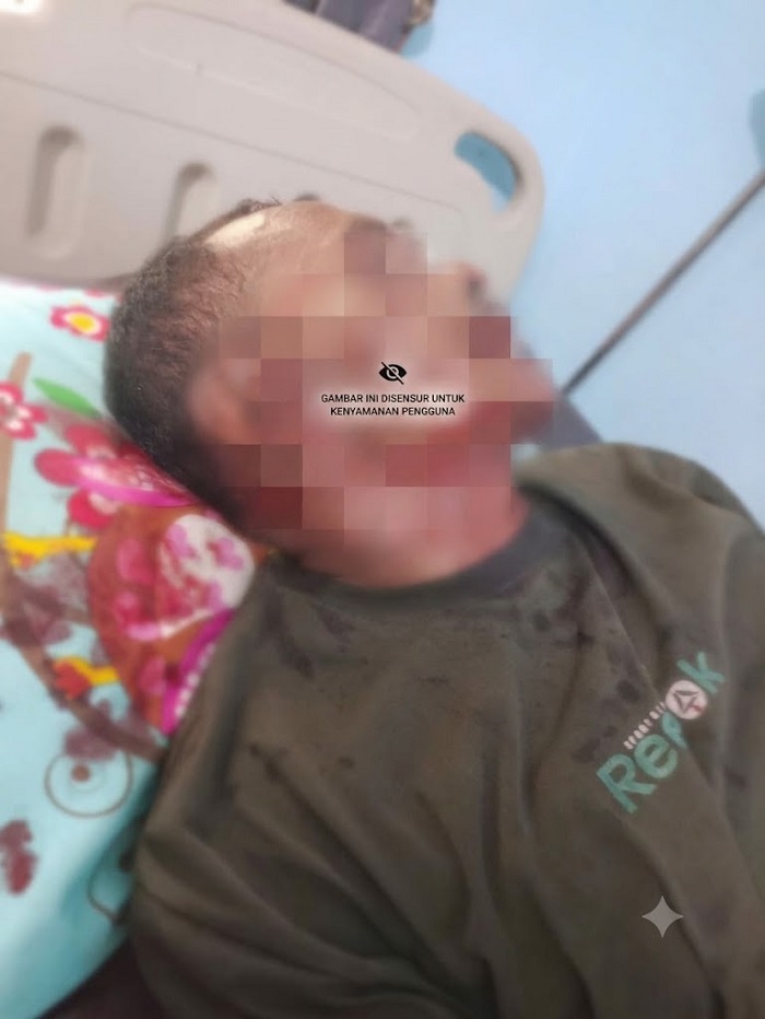 Ruang Hidup Tergerus Korporasi HTI dan Sawit, Beruang Terkam Warga Pelalawan Hingga Kritis, BKSDA Riau Dinilai Pasif