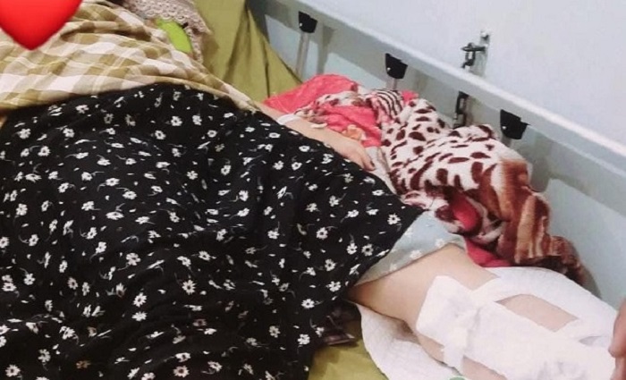 Ngeri! Siswi SMA di Kuansing Lagi Enak Tidur Malah Dililit Ular Piton Sebesar Lengan, Begini Kronologinya