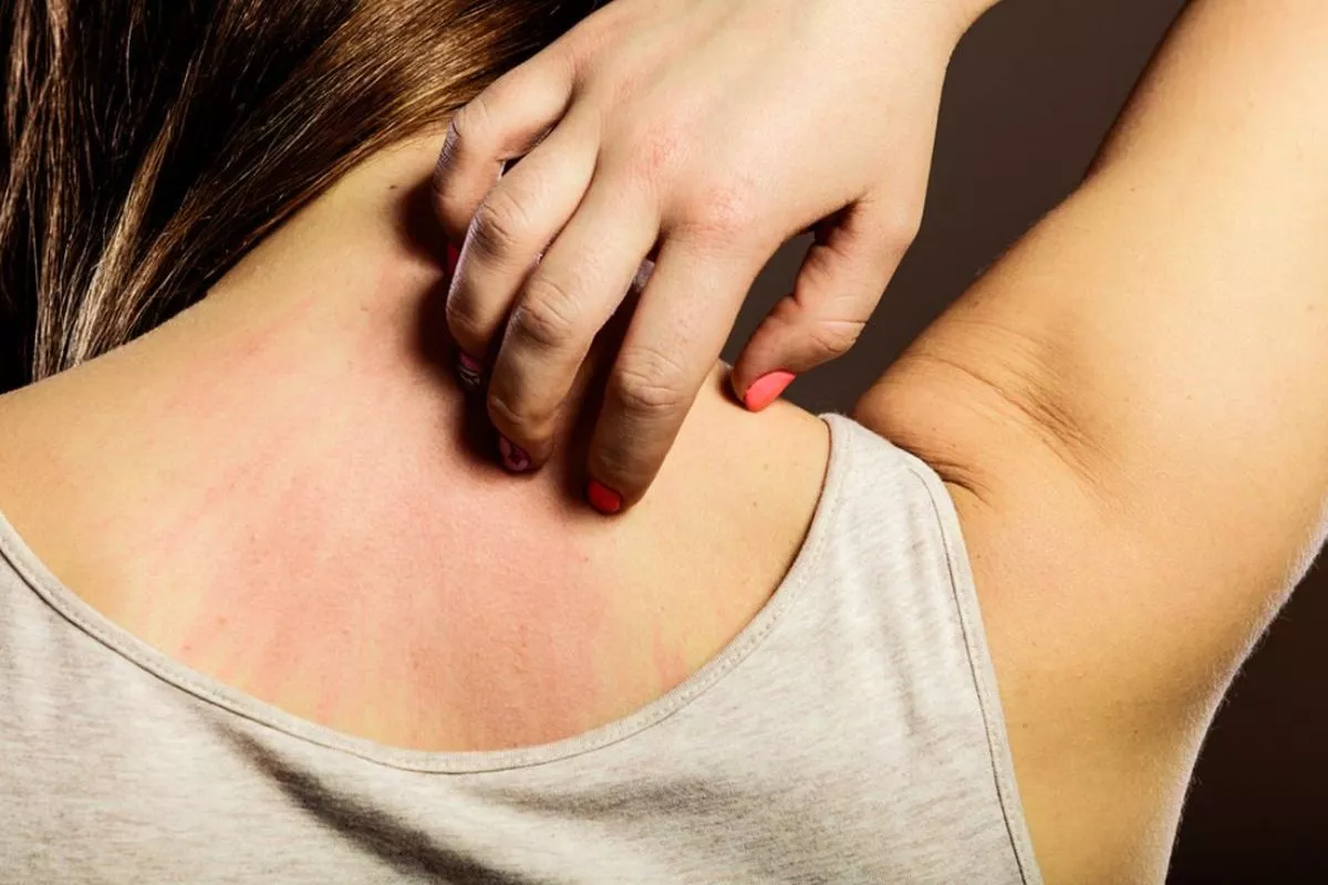 Kulit Merah dan Gatal Usai Mandi? Rahasia Tips Mandi untuk Kulit Sensitif